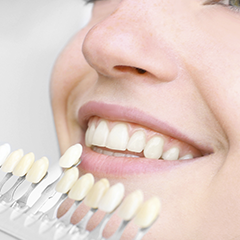 Featured image for “Sbiancamento Dentale: 3 falsi miti da sfatare per un sorriso perfetto”